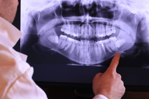 Best Knocked-Out Tooth Emergency  in Cumings, TX